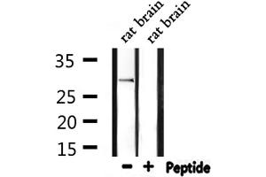 Western blot analysis of extracts from rat brain, using Ribosomal Protein S2 Antibody. (RPS2 antibody  (C-Term))