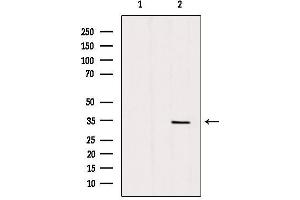 Western blot analysis of extracts from mouse brain, using SLC25A5 Antibody. (SLC25A5 antibody  (Internal Region))