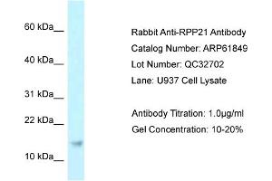 Western Blotting (WB) image for anti-Ribonuclease P/MRP 21kDa Subunit (RPP21) (Middle Region) antibody (ABIN2788924) (RPP21 antibody  (Middle Region))