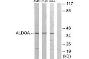 Western blot analysis of extracts from A549/HeLa/HT-29 cells, using ALDOA Antibody.