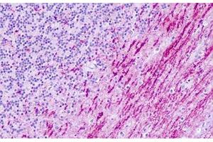 Serotonin Receptor 6 antibody  (C-Term)