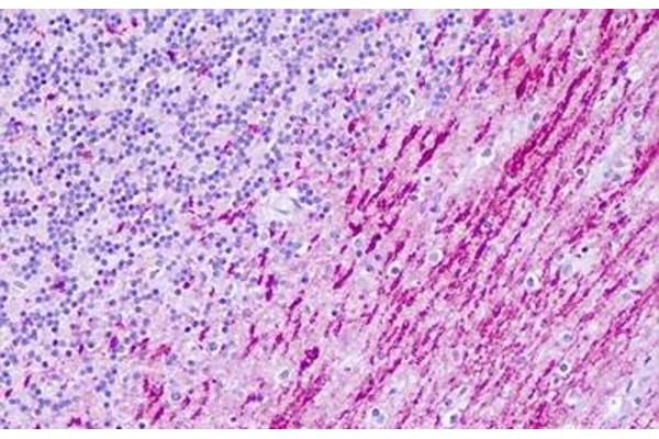 Serotonin Receptor 6 antibody  (C-Term)