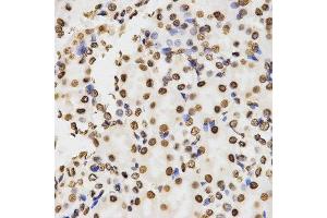 Immunohistochemistry of paraffin-embedded mouse kidney tissue using H3K9me2 antibody at dilution of 1:200 (x400 lens). (Histone 3 antibody  (H3K9me2))