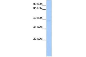 RPL3 antibody used at 1 ug/ml to detect target protein. (RPL3 antibody  (C-Term))