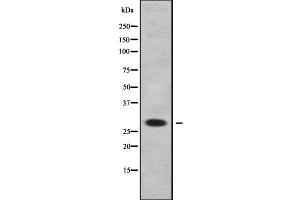 Western blot analysis of DHRS11 using Jurkat whole cell lysates