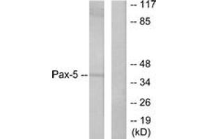 Western blot analysis of extracts from 293 cells, using Pax-5 Antibody. (PAX5 antibody  (AA 1-50))