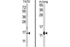 (LEFT) Western blot analysis of PEA-15 Antibody (C-term) in T47D cell line lysates (35ug/lane). (PEA15 antibody  (C-Term))