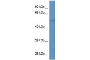 anti-Solute Carrier Family 37 (Glycerol-3-Phosphate Transporter), Member 2 (SLC37A2) (AA 300-349) antibody