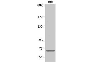 Western Blotting (WB) image for anti-Mitochondrially Encoded NADH Dehydrogenase 5 (MT-ND5) (Internal Region) antibody (ABIN3185786) (MT-ND5 antibody  (Internal Region))