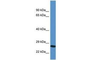 Image no. 1 for anti-Yip1 Domain Family, Member 4 (YIPF4) (AA 35-84) antibody (ABIN6747299) (YIPF4 antibody  (AA 35-84))