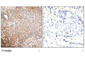 Image no. 1 for anti-Keratin 18 (KRT18) (pSer33) antibody (ABIN197076) (Cytokeratin 18 antibody  (pSer33))