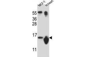 Western Blotting (WB) image for anti-Small Nuclear Ribonucleoprotein D3 Polypeptide 18kDa (SNRPD3) antibody (ABIN2912095)