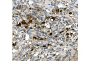 IHC analysis of GFI1 using anti-GFI1 antibody (ABIN7599380). (GFI1 antibody  (AA 1-422))