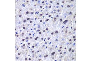 Immunohistochemistry of paraffin-embedded human liver injury using APEX1 antibody. (APEX1 antibody  (AA 1-318))