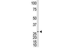 Image no. 1 for anti-Dickkopf-Like 1 (DKKL1) (C-Term) antibody (ABIN357076) (Dickkopf-Like 1 (DKKL1) (C-Term) antibody)