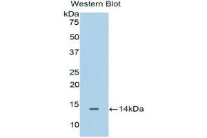 Western Blotting (WB) image for anti-Cyclin-Dependent Kinase 2 (CDK2) (AA 94-198) antibody (ABIN1175171) (CDK2 antibody  (AA 94-198))