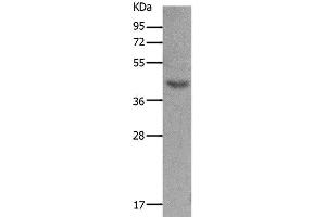 Western Blot analysis of Mouse muscle tissue using MC5R Polyclonal Antibody at dilution of 1:1200 (MC5 Receptor antibody)