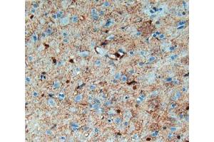 IHC-P analysis of brain tissue, with DAB staining. (S100B antibody  (AA 1-92))