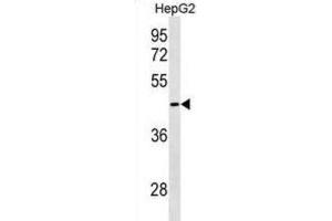 Western Blotting (WB) image for anti-GIPC PDZ Domain Containing Family, Member 3 (GIPC3) antibody (ABIN3000197) (GIPC3 antibody)