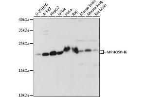 Western blot analysis of extracts of various cell lines, using MPHOSPH6 antibody (ABIN7268351) at 1:1000 dilution. (MPHOSPH6 antibody  (AA 1-160))