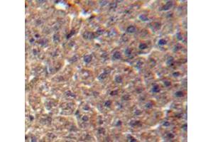 IHC-P analysis of Liver tissue, with DAB staining. (ITIH3 antibody  (AA 279-467))