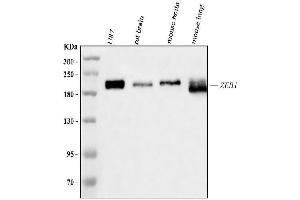 Western blot analysis of AREB6/ZEB1 using anti-AREB6/ZEB1 antibody (ABIN7602990).