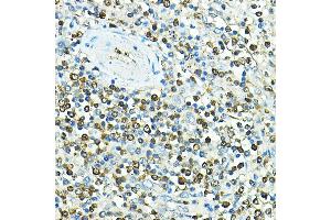 Immunohistochemistry of paraffin-embedded human spleen using CD79a Rabbit pAb (ABIN1679100, ABIN3015116, ABIN3015118 and ABIN6213808) at dilution of 1:100 (40x lens).