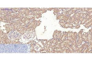 Immunohistochemistry of paraffin-embedded Rat kidney tissue using CD10 Monoclonal Antibody at dilution of 1:200. (MME antibody)