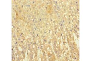 Immunohistochemistry of paraffin-embedded human adrenal gland tissue using ABIN7151346 at dilution of 1:100 (EML2 antibody  (AA 1-418))
