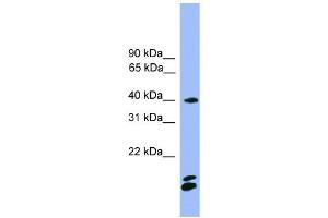 WB Suggested Anti-NFATC1 Antibody Titration: 0. (NFATC1 antibody  (N-Term))