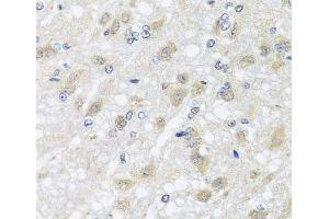 Immunohistochemistry of paraffin-embedded Rat brain using HARS2 Polyclonal Antibody at dilution of 1:100 (40x lens). (HARS2 antibody)
