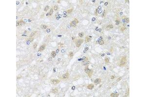 Immunohistochemistry of paraffin-embedded Rat brain using HARS2 Polyclonal Antibody at dilution of 1:100 (40x lens).