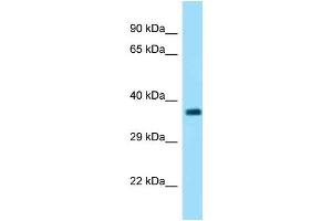 WB Suggested Anti-Fbxo2 Antibody   Titration: 1. (FBXO2 antibody  (C-Term))