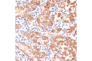 Immunohistochemistry of paraffin-embedded human stomach using HHL antibody (ABIN6132190, ABIN6141750, ABIN6141751 and ABIN6217197) at dilution of 1:100 (40x lens). (HHLA2 antibody  (AA 30-200))