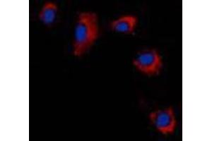 Immunofluorescent analysis of Claudin 2 staining in A431 cells. (Claudin 2 antibody  (C-Term))