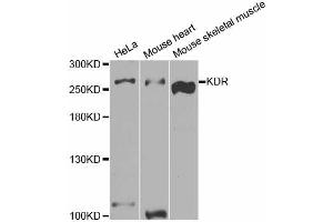 Western blot analysis of extracts of various cell lines, using KDR antibody (ABIN5973267) at 1/1000 dilution. (VEGFR2/CD309 antibody)