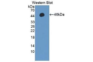 Western Blotting (WB) image for anti-Protein Phosphatase, Mg2+/Mn2+ Dependent, 1A (PPM1A) (AA 2-382) antibody (ABIN1869913) (PPM1A antibody  (AA 2-382))