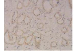 Detection of STAT3 in Human Kidney Tissue using Polyclonal Antibody to Signal Transducer And Activator Of Transcription 3 (STAT3)