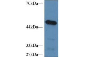 Detection of CPB2 in Mouse Heart lysate using Polyclonal Antibody to Carboxypeptidase B2 (CPB2) (CPB2 antibody  (AA 113-422))
