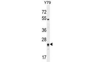 RP11-529I10. (DPCD antibody  (Middle Region))