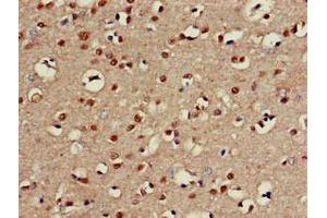 Immunohistochemistry of paraffin-embedded human brain tissue using ABIN7146672 at dilution of 1:100 (CHST1 antibody  (AA 305-397))