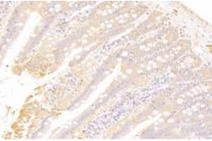 Immunohistochemistry (Paraffin-embedded Sections) (IHC (p)) image for anti-Cathepsin L2 (CTSL2) antibody (ABIN7073348)