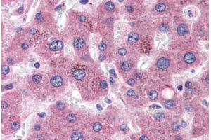 Human Liver (formalin-fixed, paraffin-embedded) stained with APOC1 antibody ABIN351488 at 3. (APOC1 antibody  (AA 70-83))