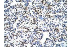 Image no. 1 for anti-Mitochondrial Ribosomal Protein S15 (MRPS15) (AA 51-100) antibody (ABIN6737717) (MRPS15 antibody  (AA 51-100))
