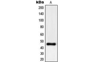Western blot analysis of PHKG1 expression in A375 (A) whole cell lysates. (PHKG1 antibody  (Center))