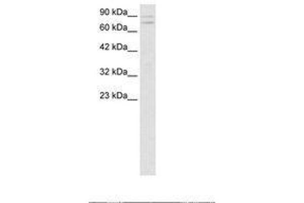 ZNF81 antibody  (C-Term)
