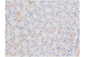 ABIN6256390 and ABIN6267486 at 1/200 staining Rat kidney tissue sections by IHC-P.