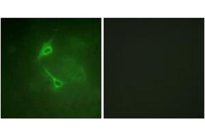 Immunofluorescence analysis of NIH-3T3 cells, using PKC zeta (Ab-560) Antibody. (PKC zeta antibody  (AA 526-575))