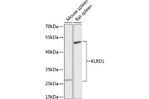 Western blot analysis of extracts of various cell lines using KLRD1 Polyclonal Antibody at dilution of 1:3000. (CD94 antibody)