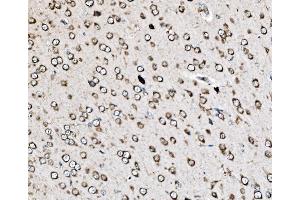 IHC analysis of MRPS25 using anti-MRPS25 antibody (ABIN7599032).